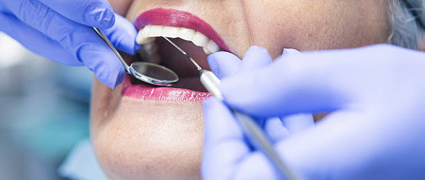 Best Emergency Treatment for Oral Infections in Oberlin, KS