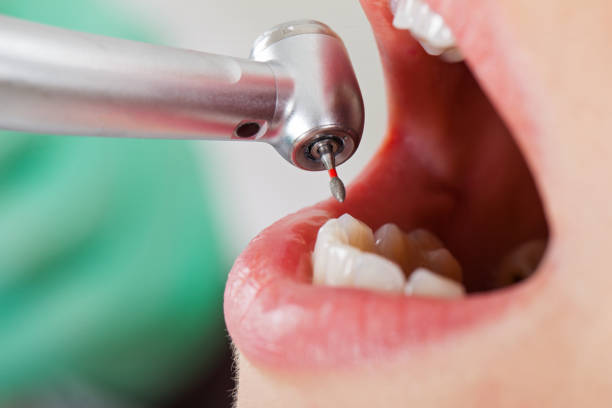 Best Emergency Denture Repair in Oberlin, KS